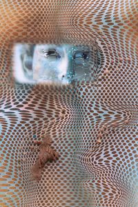 Close-up of a warped, dotted texture with skin-tag like growths and a glimpse of the top half of a human face.